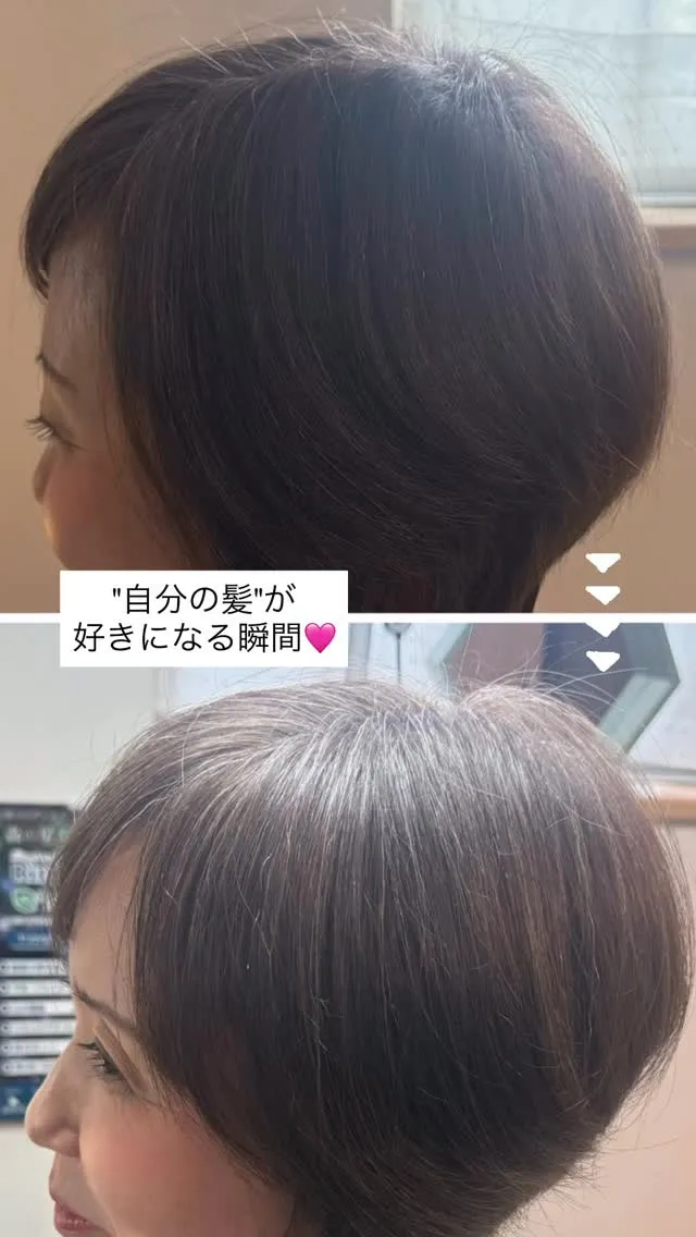 💫Before → After💫