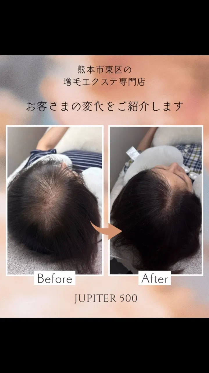 【つむじの透け感・ボリュームのお悩みに🌿】